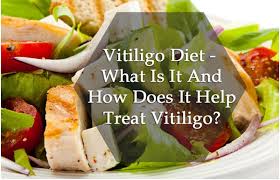 Role Of Diet In Vitiligo Foods To Eat Avoid In Vitiligo