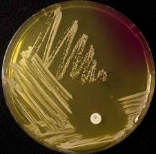 Image result for Staphylococcus Saprophyticus
