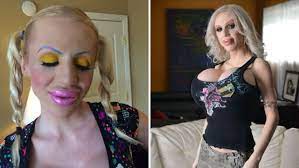 Wydała krocie na operacje plastyczne - Juliette Stray wreszcie osiągnęła  swój cel! - aju.pl