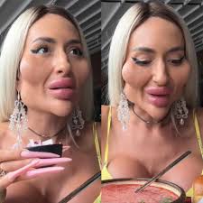 From natural beauty to an extreme transformation!” 😲💔 This woman has the  world's largest cheekbones, but she recently shared photos of herself  before her transformation. 😟🤯 The internet is buzzing with reactions,