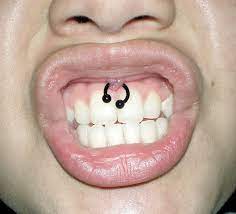 This is just a quick video i made to how to change your smiley piercing ! How To Clean Smiley Piercings