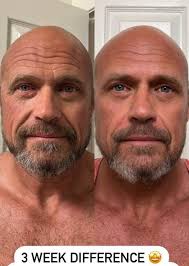 What a skincare routine needs to repair and hydrate the skin barrier, not  break it down