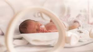 Conus sous aortique se développe et le conus sous pulmonaire involue conus sous aortique normalement développé: Temoignages Mon Enfant Est Atteint De La Maladie Bleue Magicmaman Com