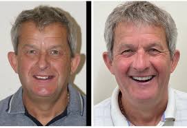 THE VB• 'Dr Dee, Here's a picture of my new smile! Thank you so much' One  of patients from Manchester who we have treated with complete replacement  dentures. That's right she has