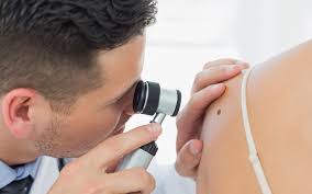 Skin cancer of the head and neck treatment. After Mother Gets Ill Son Develops Early Skin Cancer Detecting Device The Times Of Israel