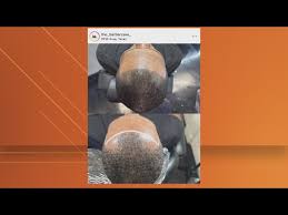 What is scalp micropigmentation? Texas barbershop owner, client speak