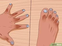 Lupus is chronic inflammatory condition caused by an autoimmune disease. Lupus Diagnostizieren Wikihow