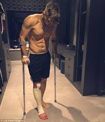 Luke shaw has a nasty scar on his calf from the horror injurycredit: Manchester United S Luke Shaw Posts Pic Of Him Putting Weight On Leg Man Utd News Manchester United England Football Team