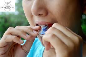 My experience was that i wore my retainer day and night for a few years, then i was able to wear it just nights for a few more years.then i lost it and never got it replaced. How Long Should You Wear An Orthodontic Retainer Texas Orthodontic Specialists