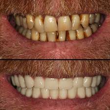 Newport Dental Group