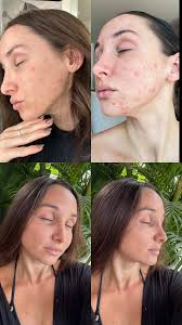 Hi everyone 👋 I'm super passionate about everything related to IBD