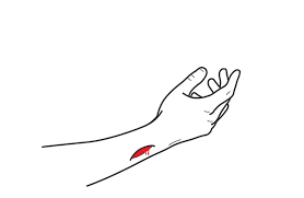 Je nach größe der wunde näht er dann mit dem entsprechendem faden und einer anzahl von stichen. Druckverband Bei Tiefen Wunden Am Arm Erste Hilfe Am Berg Lab Rock