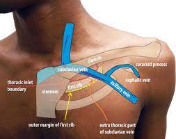 Anatomic Considerations For Venous Access How To Pace