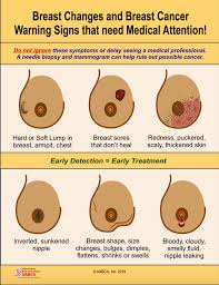 The most common sign of breast cancer that you may notice is a painless lump in your breast, potentially indicating a tumor. Breast Cancer Signs Symptoms And Screening Recommendations Habesha Health