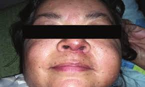 Portada Volumen 32 N°3_SVMI