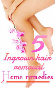 If you are troubled with ingrown hair or bumps on your legs, you must try these remedies to get smooth legs naturally at home. 5 Ingrown Hair Removal Home Remedies Wetellyouhow