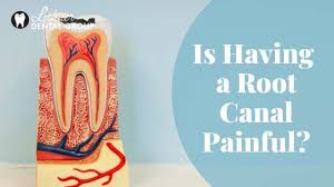 However, this is a case by case scenario. Is Having A Root Canal Painful