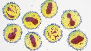 They may cause severe diseases. Hantavirus Das Sind Die Symptome Des Gefahrlichen Virus Sudwest Presse Online