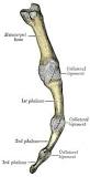 Image result for icd 10 code for ulnar collateral ligament tear thumb