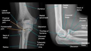 Image result for Elbow XRay