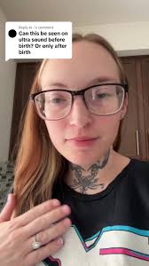 Replying to @- #genetictesting #criduchatsyndrome #nipttesting #ultrasounds