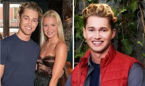 There are different areas, and there are different degrees of burn and. Aj Pritchard Girlfriend How Did Aj And Girlfriend Abbie First Meet Techiazi