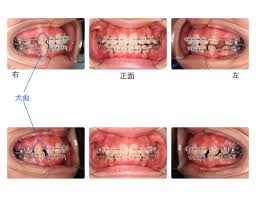 福岡天神矯正歯科 - アールエフ矯正歯科