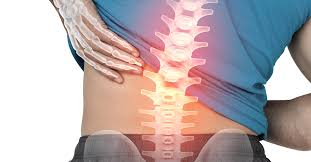 Understanding the anatomy of lower back pain / 0 watchers905 page views0 deviations. How To Destroy Your Spine Part 1 Seattle Wa Brain And Spine Surgery