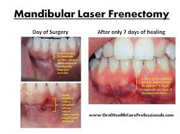 Pin On Dentistry