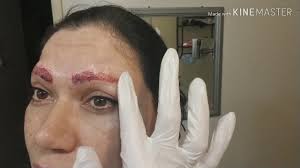 We did not find results for: Laser Tattoo Removal One Week Down Time Youtube
