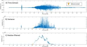 Before the lie detector test commences, the employee is legally entitled to basic information surrounding the reason for the test. Detection Of Generalized Tonic Clonic Seizures From Ear Eeg Based On Emg Analysis Sciencedirect