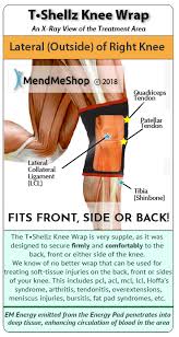 Where are the children playing? Medial Meniscus