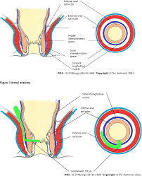 Pdf Guidelines To Diagnose And Treat Peri Levator High Anal | Hot Sex  Picture
