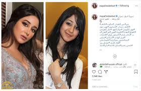 ولكن قبل الدخول في التفاصيل لا تنسى ان تكتب استفساراتك عن عملية شفط الدهون أو أي استفسار اخر يخص عمليات التجميل في تعليق اخر الصفحة أو الإتصال بنا على رقم 00201011317694. Ø´Ø§Ù‡Ø¯ Ù…ÙŠ Ø§Ù„Ø¹ÙŠØ¯Ø§Ù† ØªÙ†Ø´Ø± ØµÙˆØ±ØªÙŠÙ† Ù„Ù€ Ø£Ø³ÙŠÙ„ Ø¹Ù…Ø±Ø§Ù† Ù‚Ø¨Ù„ ÙˆØ¨Ø¹Ø¯ ØªØºÙŠÙŠØ± Ø¬Ø°Ø±ÙŠ ØµØ­ÙŠÙØ© Ø§Ù„Ù…Ø±ØµØ¯