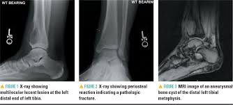 Teenager With Ankle Pain And Swelling Contemporary Pediatrics
