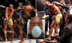 Watch anderson silva break his leg here: Anderson Silva Undergoes Knee Surgery As 45 Year Old Legend Vows To See Out Contract Daily Mail Online