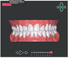 Your browser is no longer officially supported, please upgrade to a modern browser. Kunstliche Intelligenz In Der Aligner Therapie