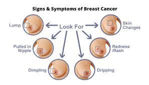 You are back in the family rotation to take out the trash. Signs And Symptoms Of Breast Cancer Medlux International Hospital