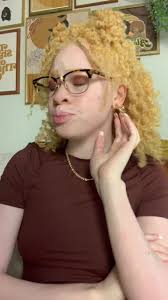 I have literally had these remarks and many more told to me growing up with  albinism and it’s quick ridiculous. We have to stop doing this!💀 #albinism  #albinismawareness
