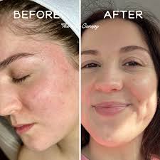 Wittney Fratt Snyder