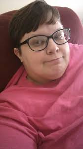 Hair style and growth 6 months after brain aneurysm surgery where they  shaved my head😭