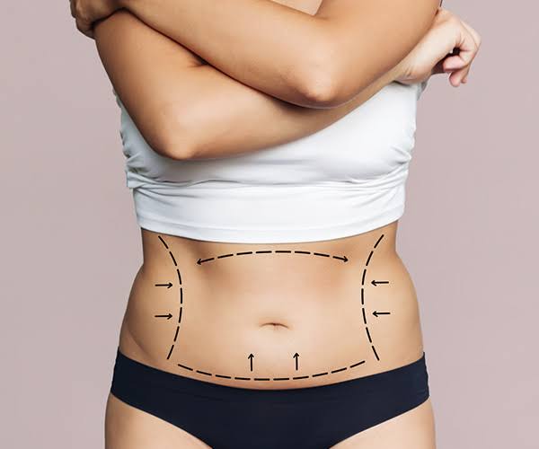 Best Tummy Tuck Clinics in Dubai: Choose the Right Provider - La Vie Clinic