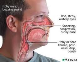 Symptoms Of Mold Allergy Watery Eyes Mucus Cough Mucus In Throat