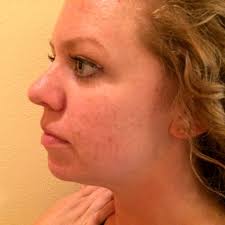 Facials & Treatments