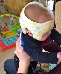 Plate forme civique (po) logo officiel présentation leader. La Plagiocephalie De Petit Prince Port De L Orthese Cranienne Et Bilan Dans Ma Tribu