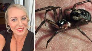 Black widow bites suck, but they are not as serious as they're made out to be. False Widow Spider Bite Leaves Barry Woman In Hospital Bbc News