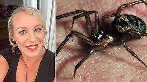 Black widows can be found throughout the united states but are most common in warmer and drier the victim of a black widow spider's bite usually feels it right away, and there may be fang marks and swelling. False Widow Spider Bite Leaves Barry Woman In Hospital Bbc News