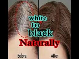 Whitening of hair is a sign of ageing. White Hair Problem In Young Age Urdu Youtube
