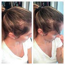 If you really want to. Why I Take Collagen How I Use Collagen Physical Kitchness