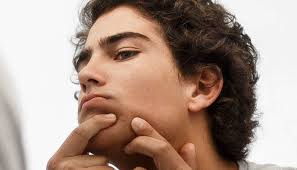 In five minutes, the person had vacuumed their entire face, and then the bruises slowly started to pop up. Blood Filled Pimples Causes Treatment And Types